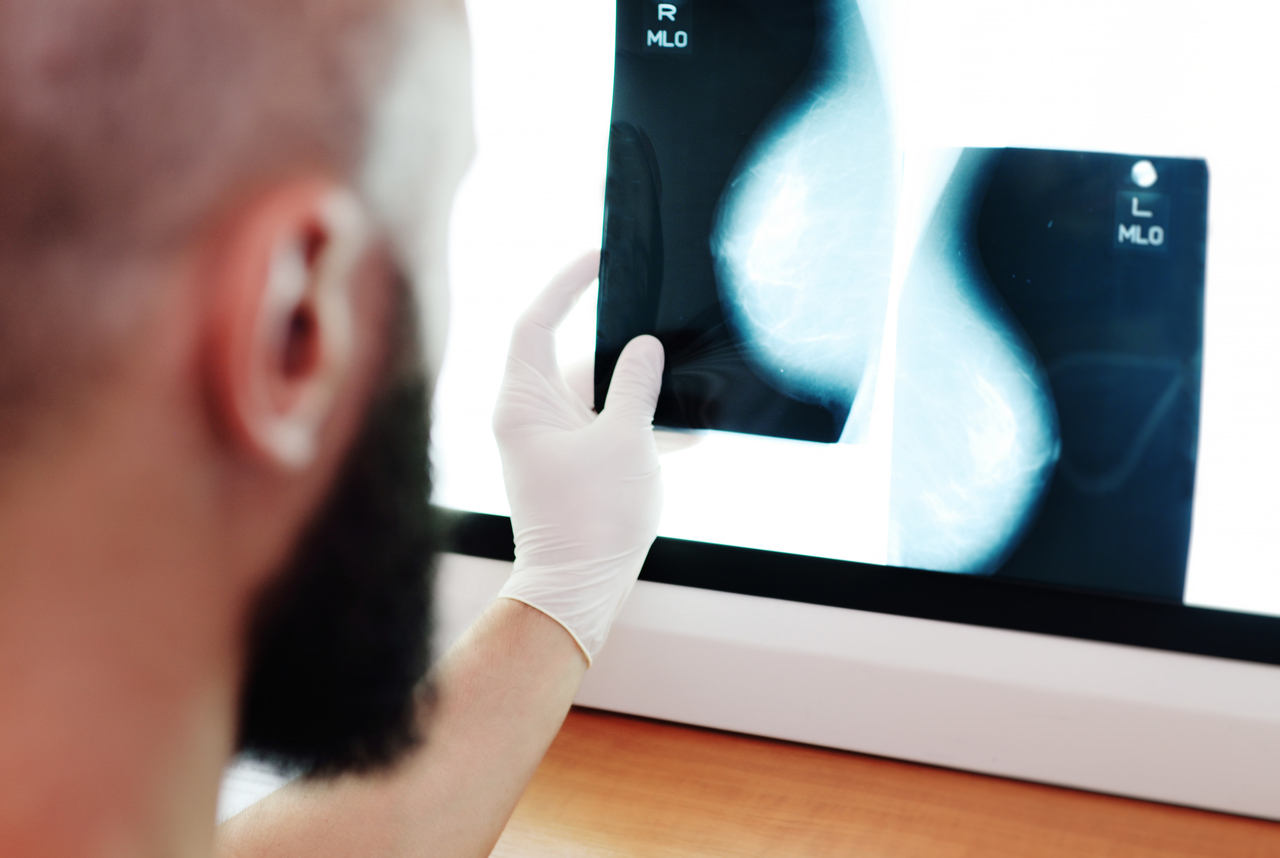 A doctor looking at the x-ray from a mammogram