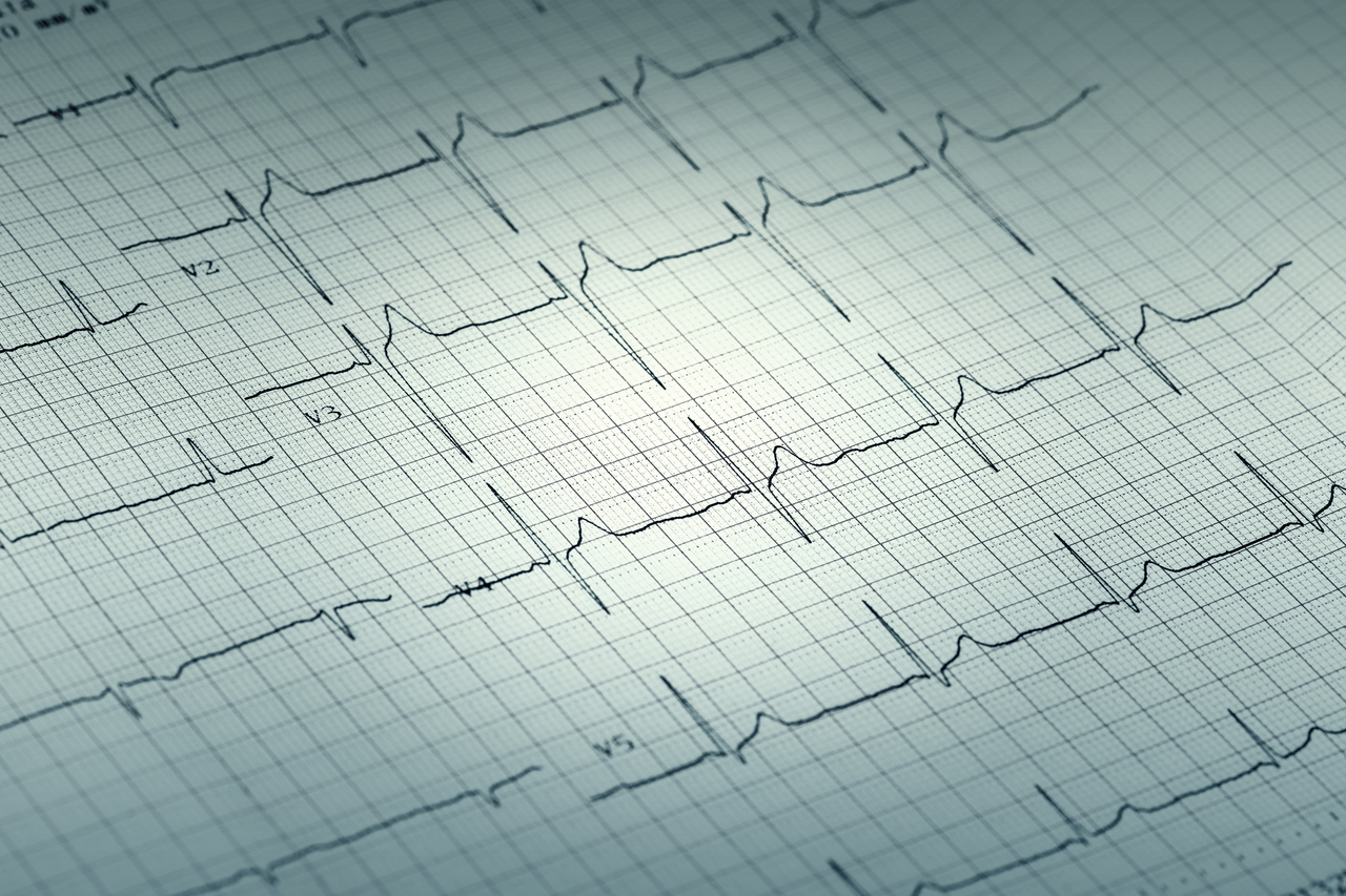 A graph of a person's heartbeat