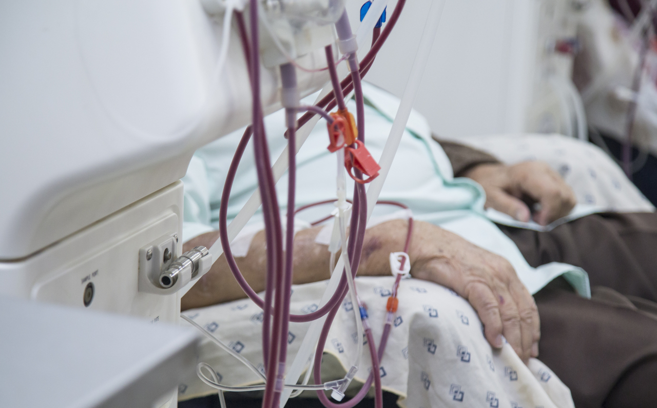 A man's vascular access for hemodialysis