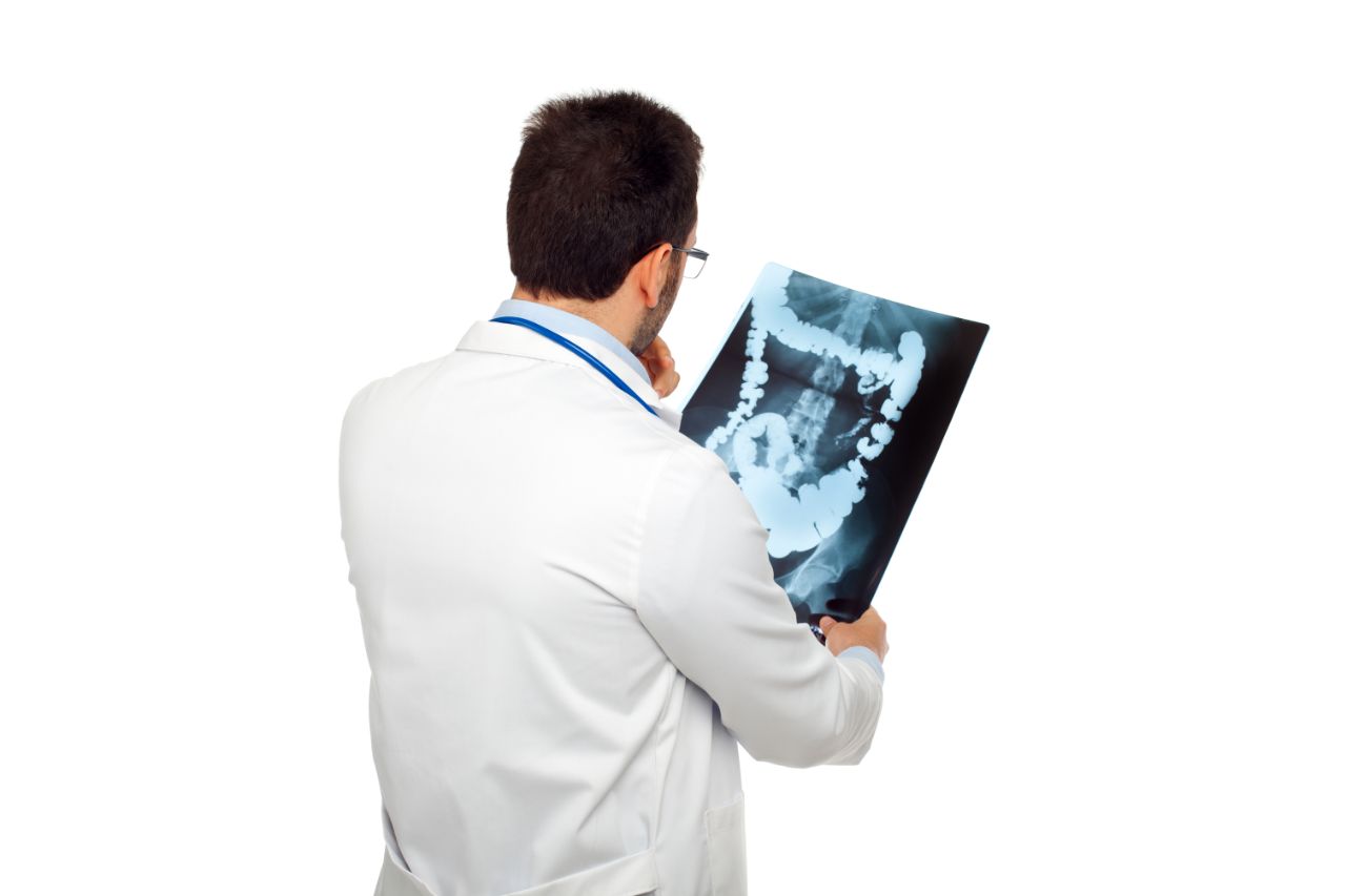Doctor holding colon xray