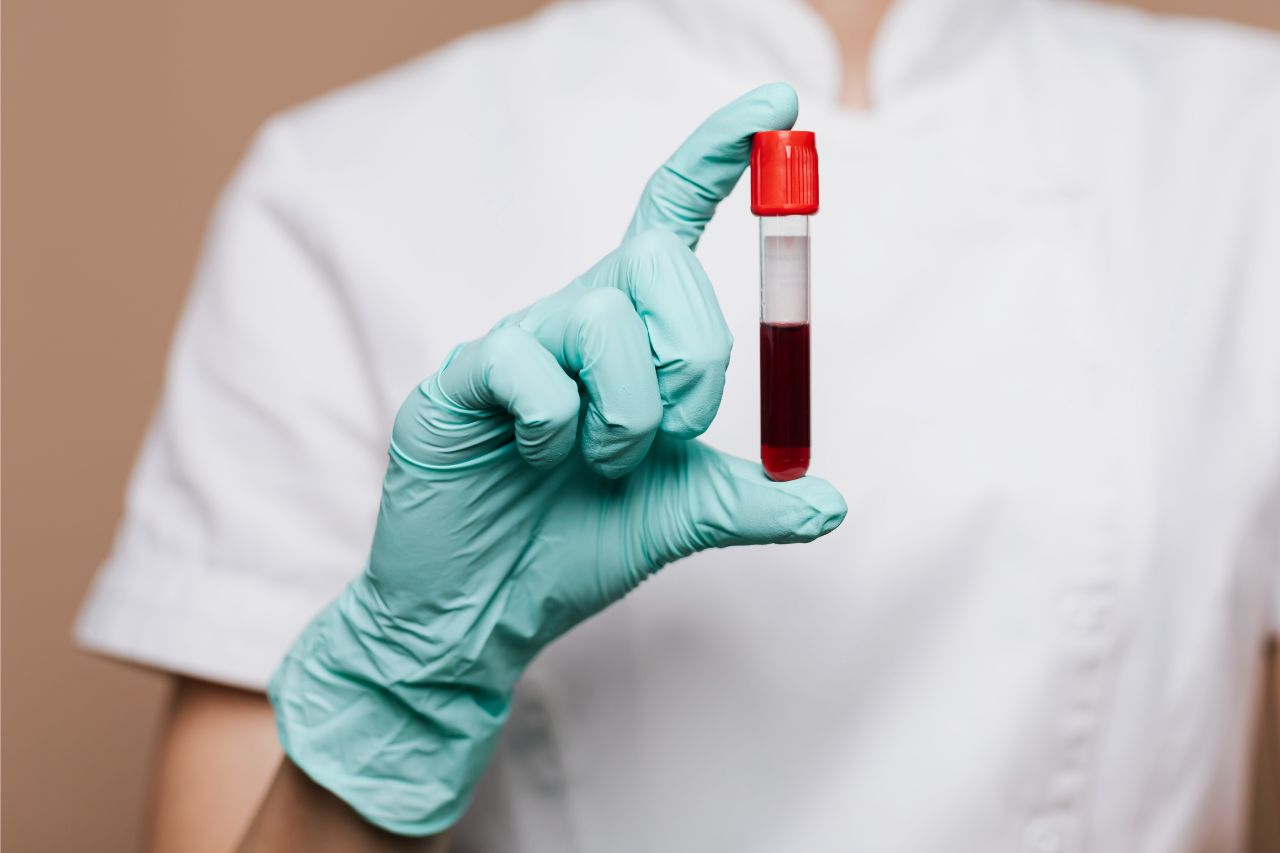 Lipid Blood Test 